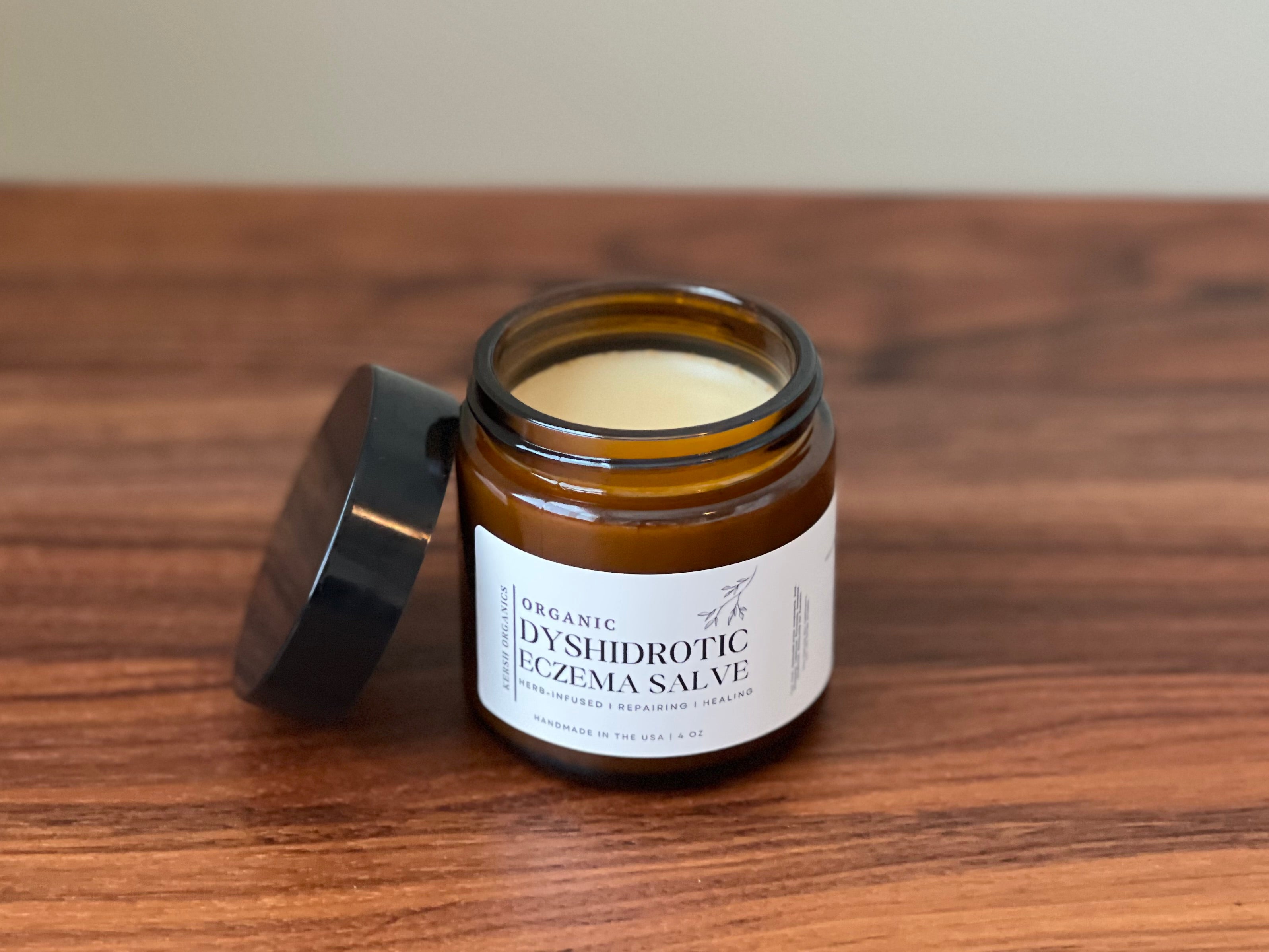 eczema cream