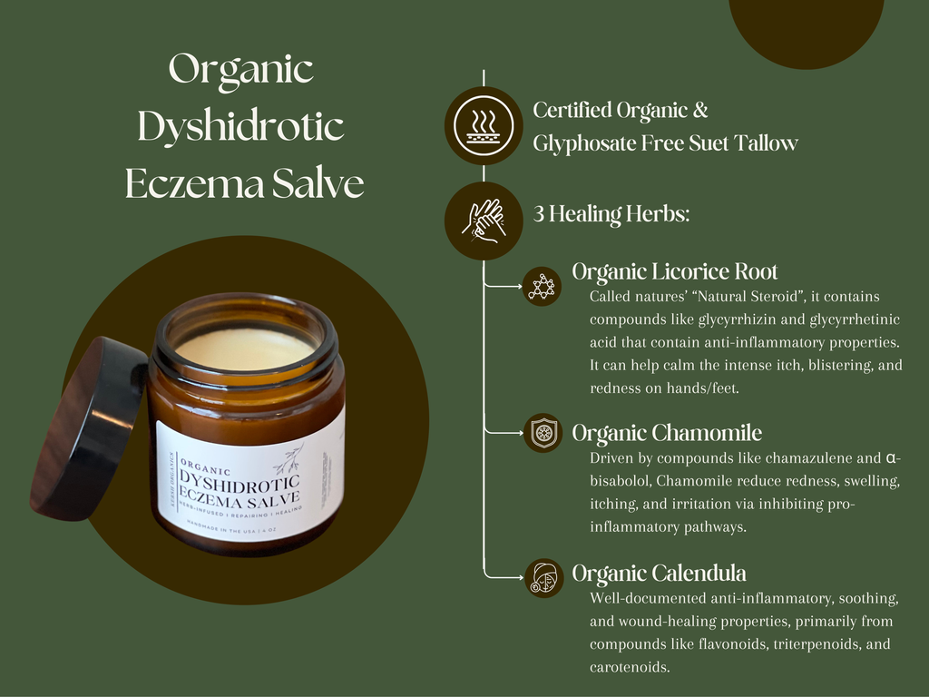 best hand cream for dyshidrotic eczema